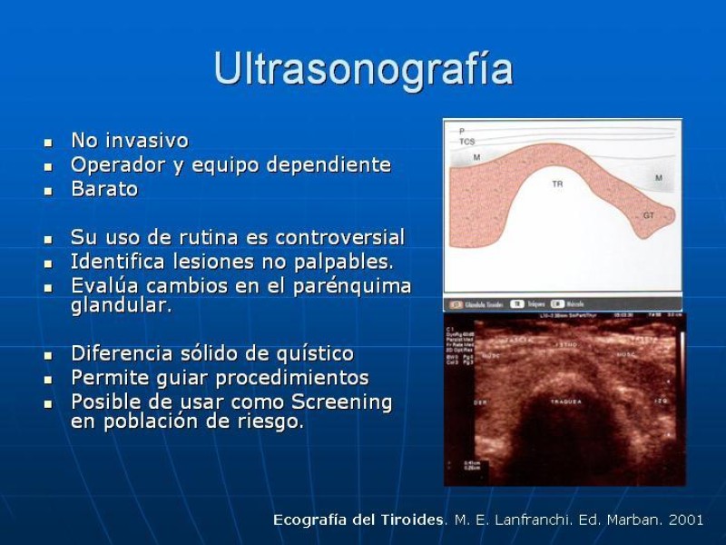 Diapositiva 8 de Estudio del Nódulo Tiroídeo