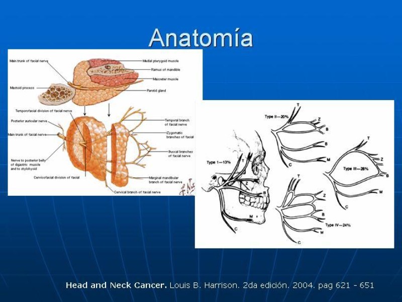 Diapositiva 3 de Tumores de las Glándulas Parótidas