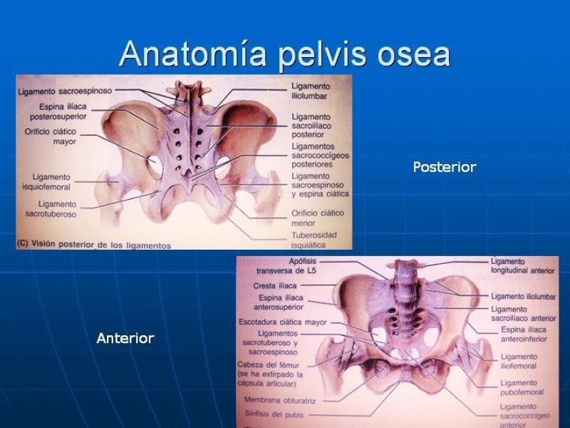 Diapositiva 2 de Fractura de Pelvis
