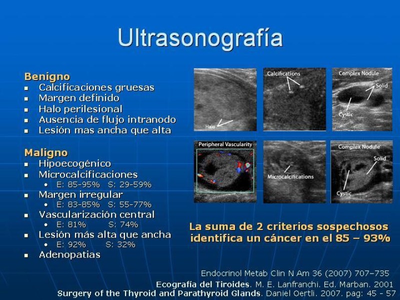 Diapositiva 11 de Estudio del Nódulo Tiroídeo