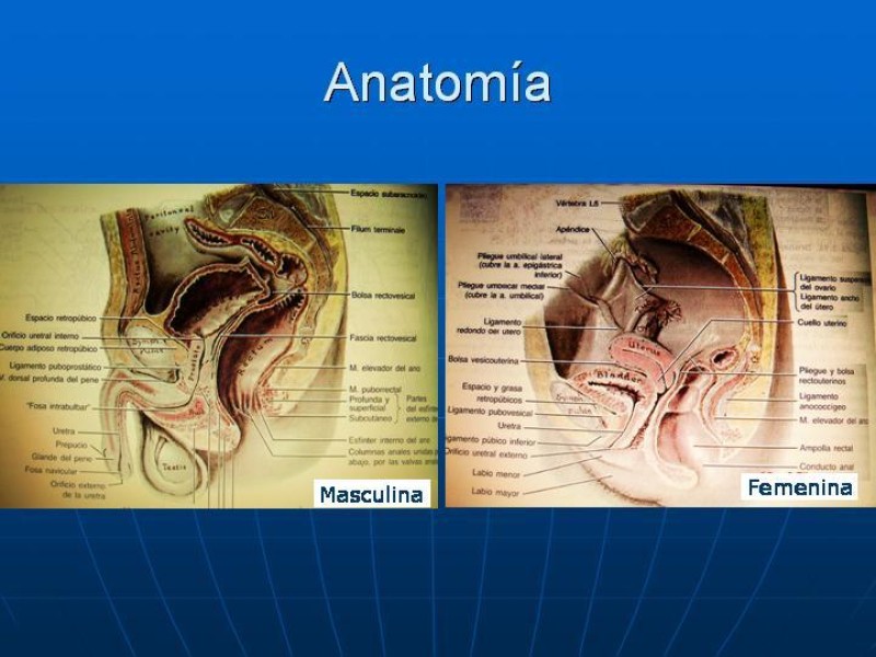 Diapositiva 1 de Fractura de Pelvis