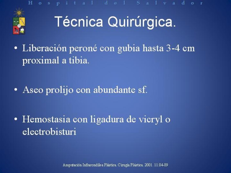 Diapositiva 13 de Amputación Infracondilea.