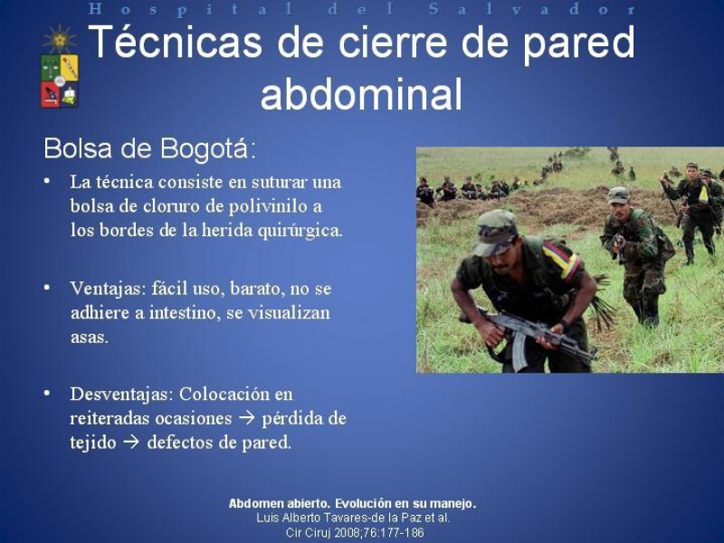 Diapositiva 10 de Vacuum-Assisted Closure en laparotomía. 