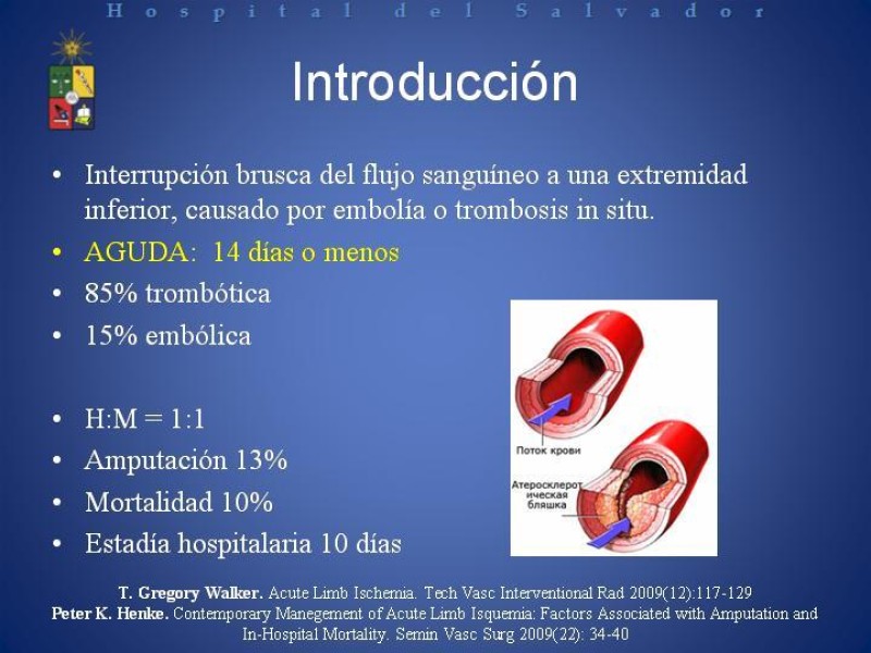 Diapositiva 1 de Isquemia arterial aguda en EEII