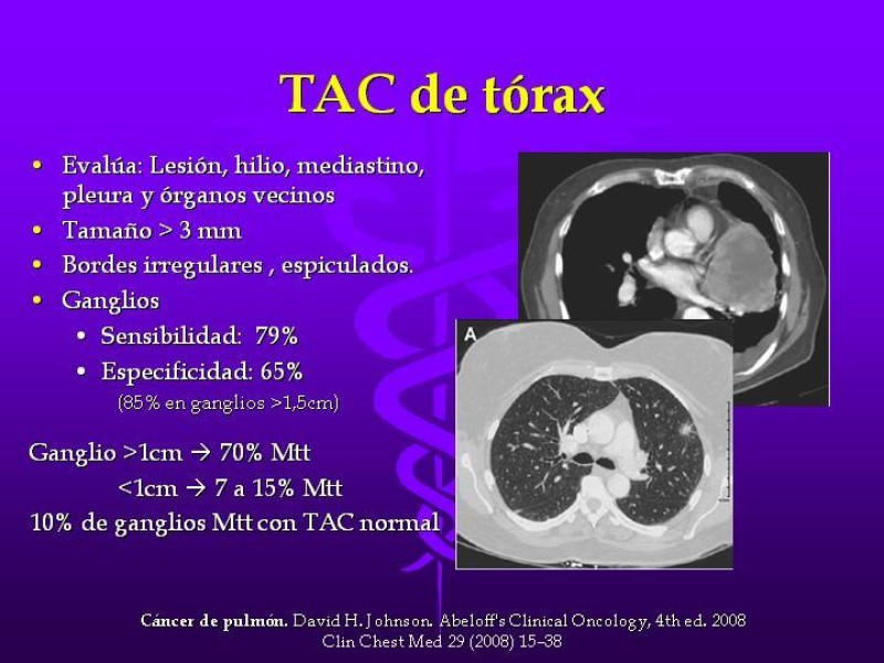 Diapositiva 27 de Cáncer de pulmón