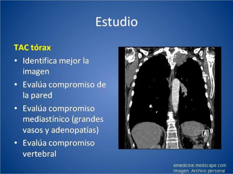 Diapositiva 9 de Tumor de Pancoast
