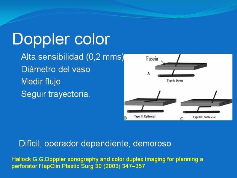 Diapositiva 16 de Colgajos estilo libre: Aplicación en cirugía reparadora