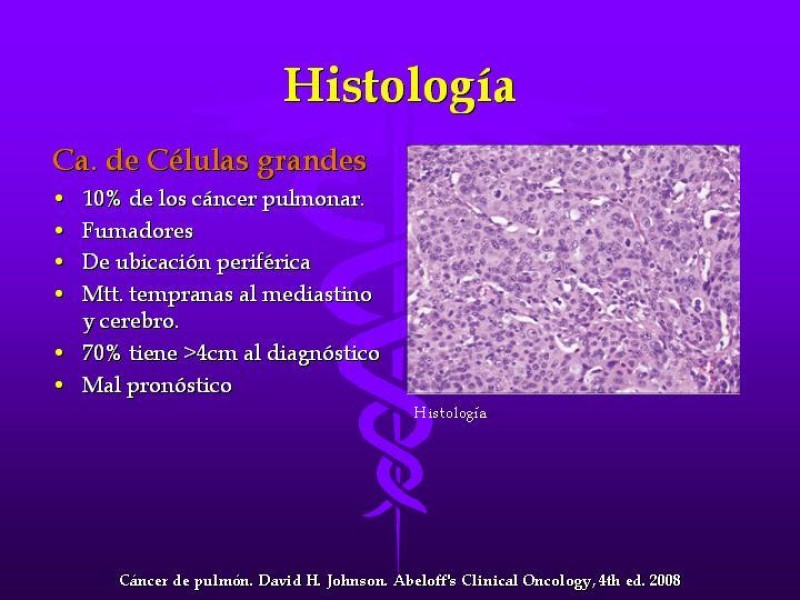 Diapositiva 22 de Cáncer de pulmón