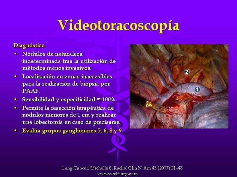 Diapositiva 30 de Cáncer de pulmón