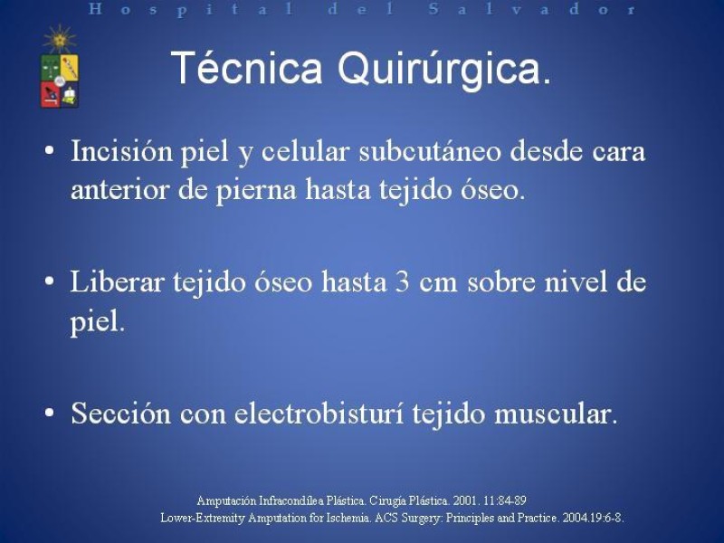Diapositiva 10 de Amputación Infracondilea.