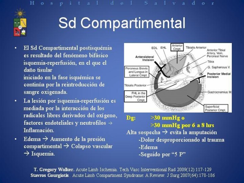 Diapositiva 28 de Isquemia arterial aguda en EEII