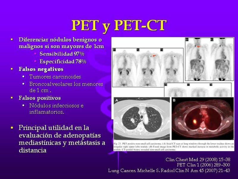 Diapositiva 34 de Cáncer de pulmón