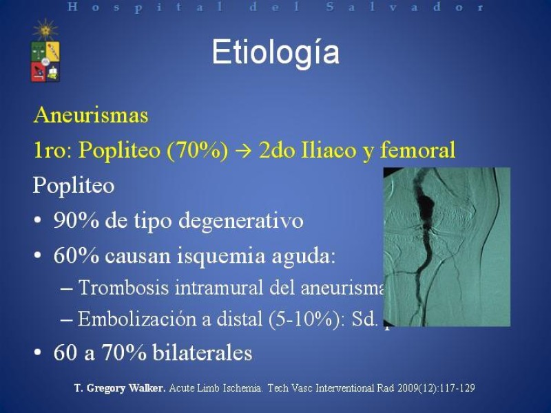 Diapositiva 6 de Isquemia arterial aguda en EEII