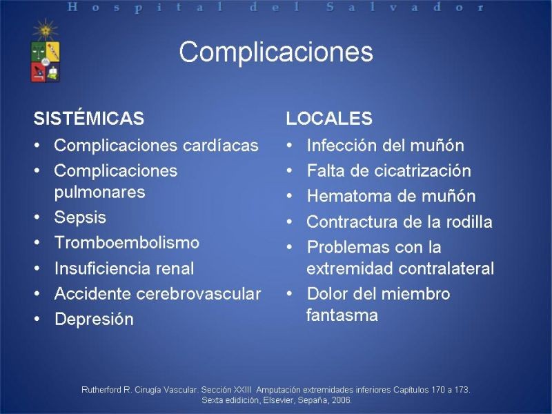 Diapositiva 49 de Amputaciones de extremidades inferiores