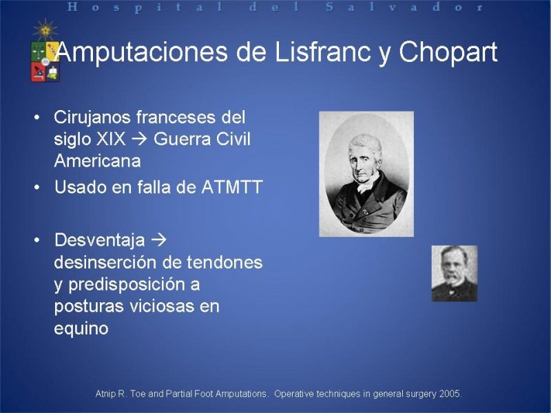 Diapositiva 32 de Amputaciones de extremidades inferiores