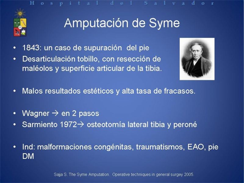 Diapositiva 35 de Amputaciones de extremidades inferiores