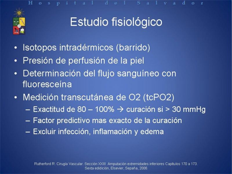 Diapositiva 13 de Amputaciones de extremidades inferiores