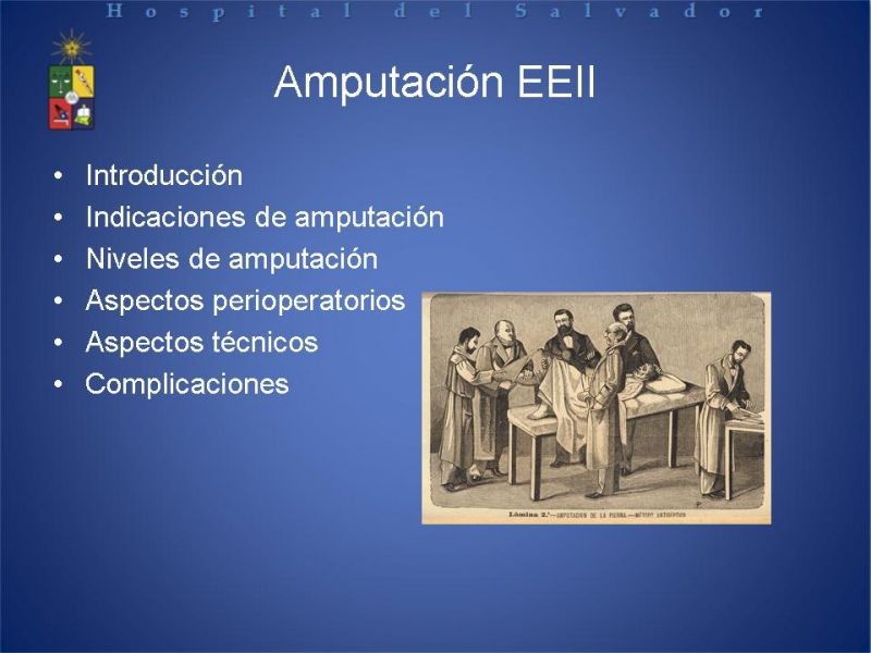 Diapositiva 1 de Amputaciones de extremidades inferiores