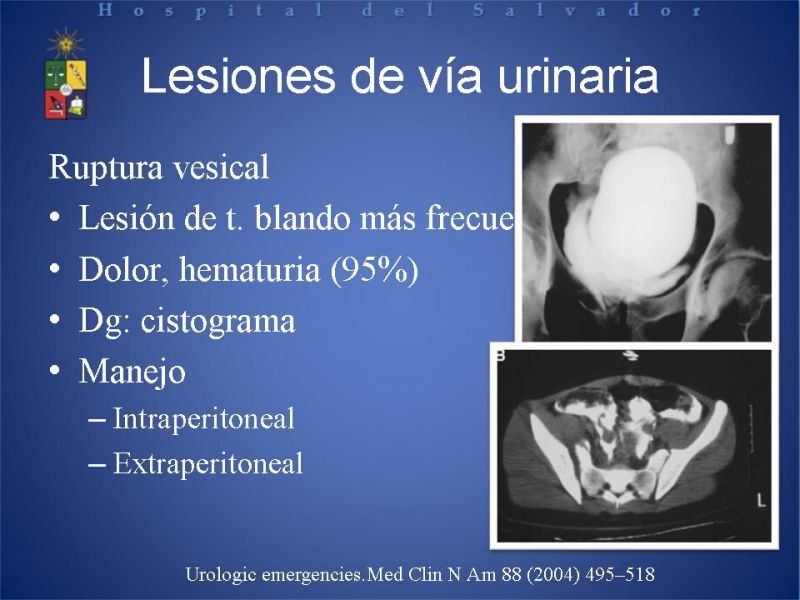 Diapositiva 16 de Trauma de pelvis