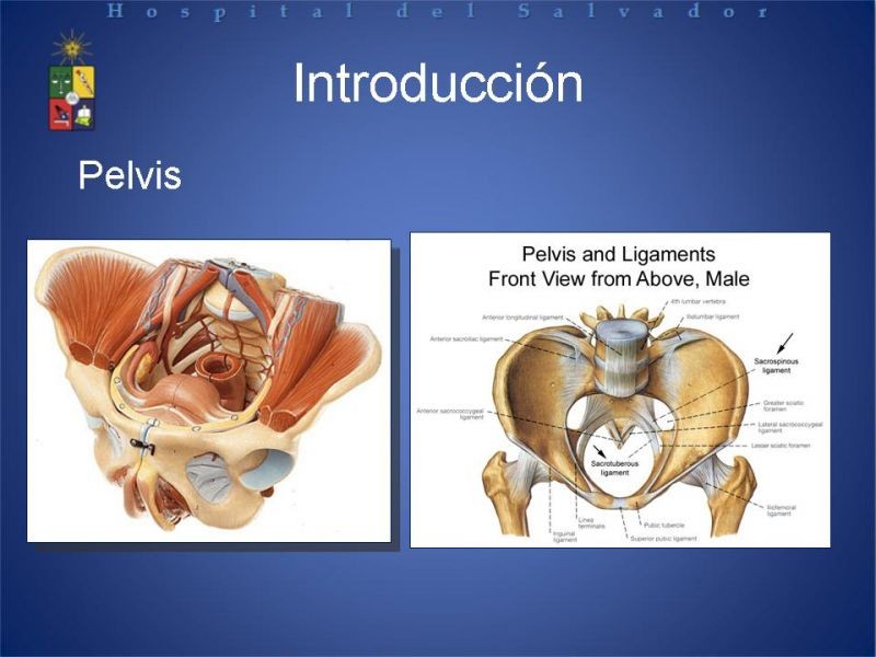 Diapositiva 1 de Trauma de pelvis