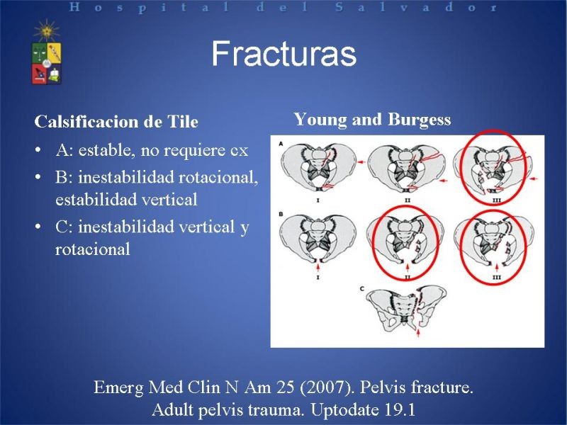 Diapositiva 4 de Trauma de pelvis