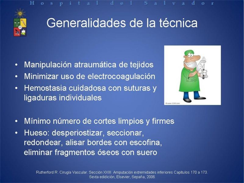 Diapositiva 14 de Amputaciones de extremidades inferiores