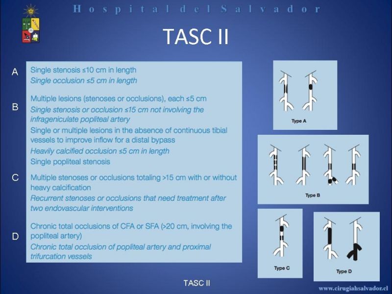 Diapositiva 11 de Angioplastía vs By Pass en isquémia crítica