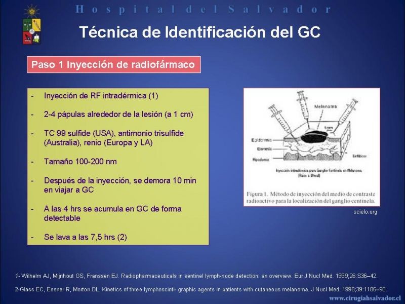 Diapositiva 25 de Rol del Ganglio Centinela en Melanoma