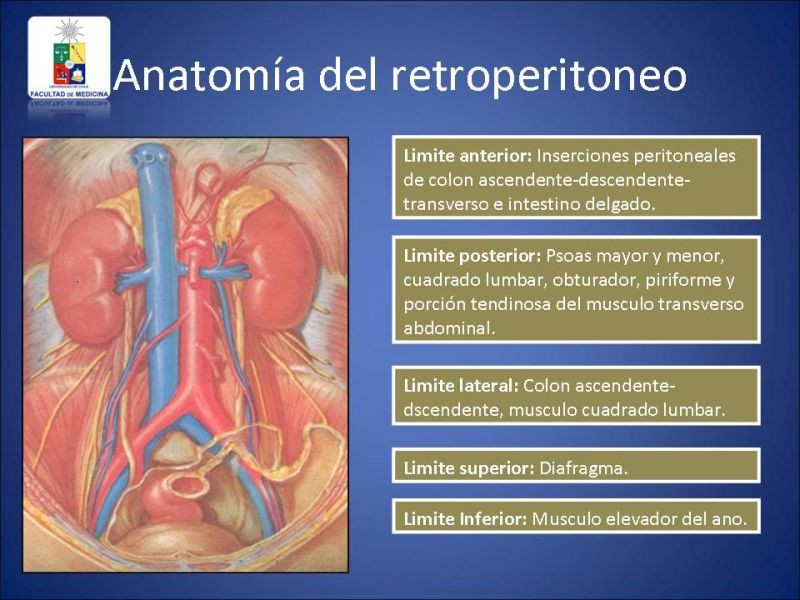 Diapositiva 1 de Sarcoma Retroperitoneal