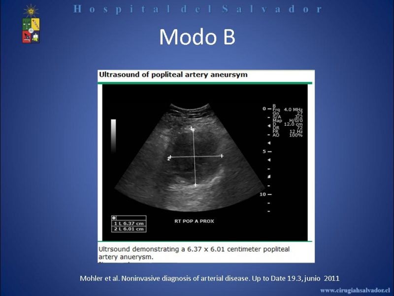 Diapositiva 28 de Laboratorio Vascular en EAO