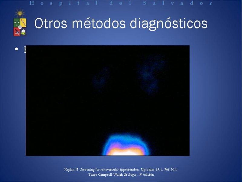 Diapositiva 14 de Hipertensión renovascular