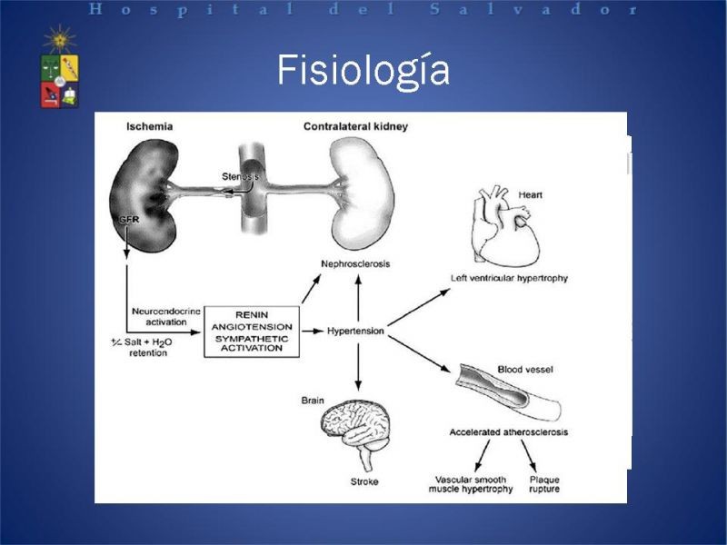 Diapositiva 5 de Hipertensión renovascular