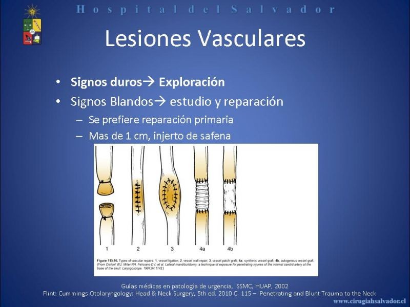 Diapositiva 17 de Trauma Vascular Cervical