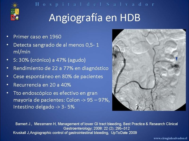 Diapositiva 2 de Angiografía en Hemorragia Digestiva