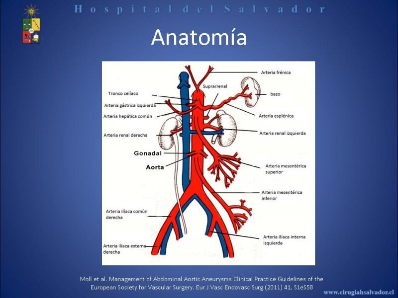 Diapositiva 5 de Abordaje de Aorta abdominal