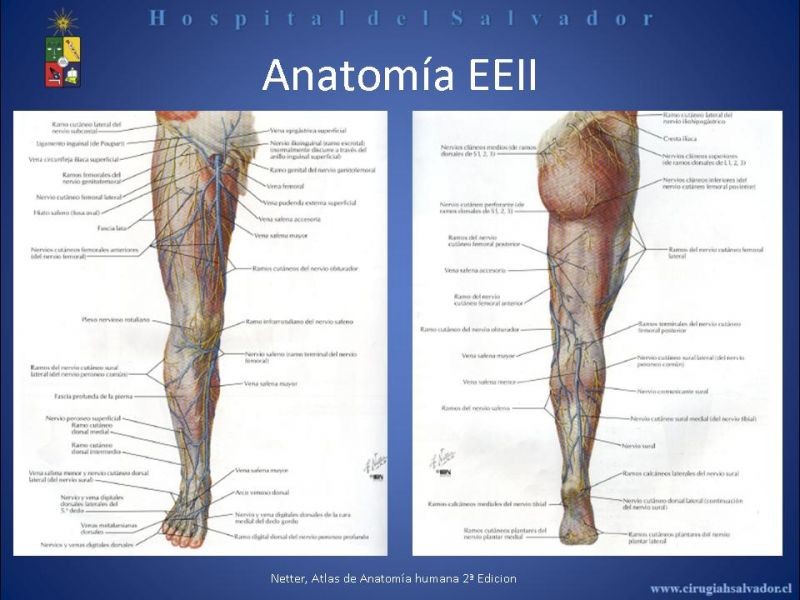 Diapositiva 3 de Safenectomía