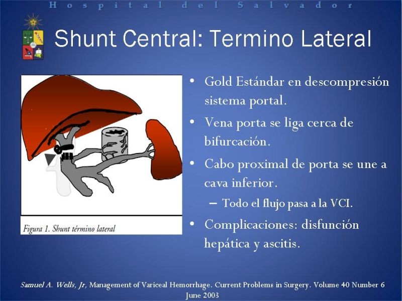 Diapositiva 23 de Hipertensión Portal:Alternativas Terapeuticas