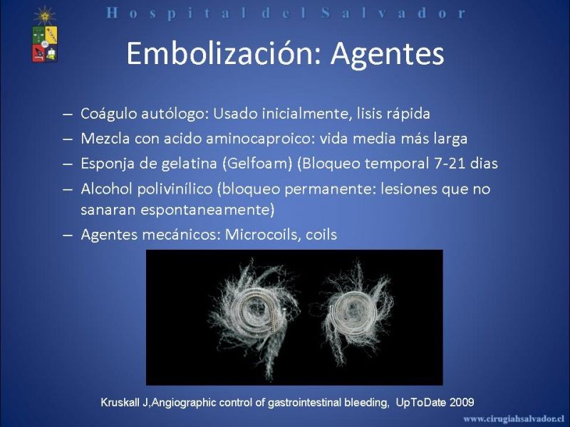 Diapositiva 14 de Angiografía en Hemorragia Digestiva