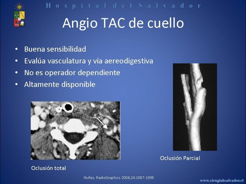 Diapositiva 20 de Trauma Vascular Cervical
