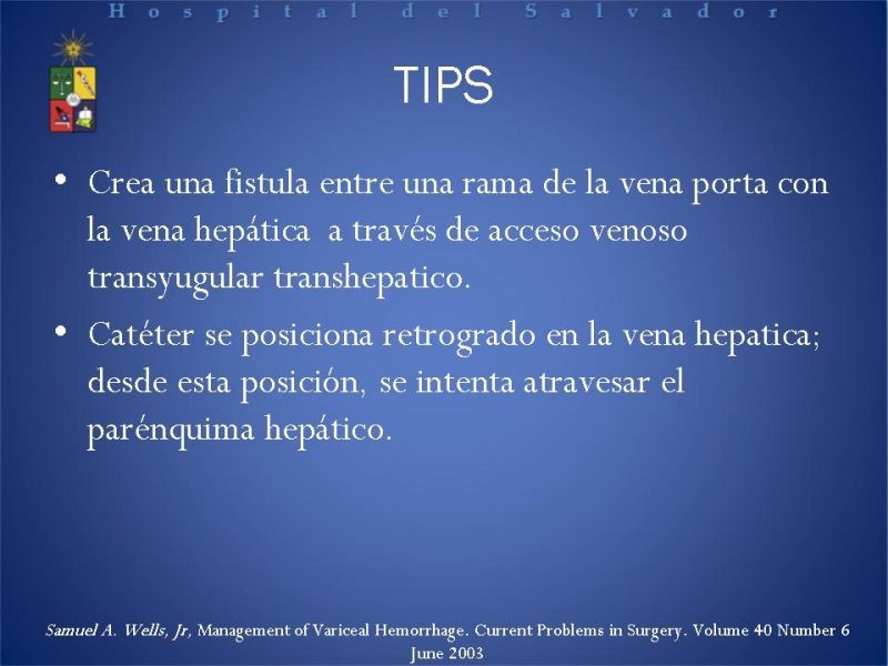 Diapositiva 29 de Hipertensión Portal:Alternativas Terapeuticas