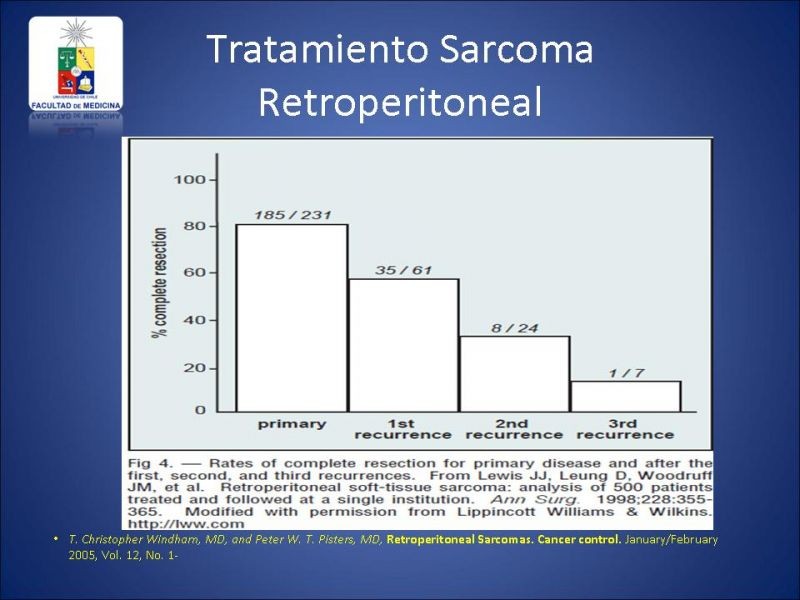 Diapositiva 20 de Sarcoma Retroperitoneal