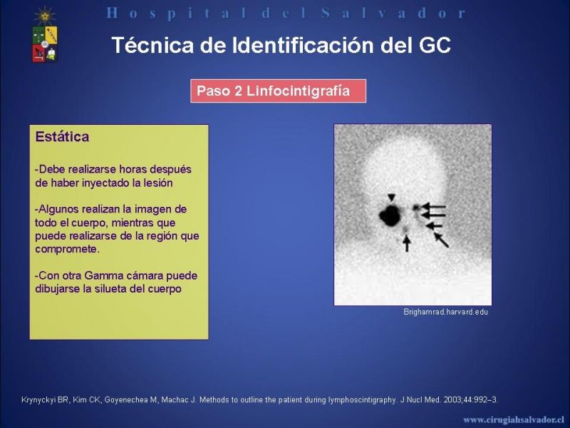 Diapositiva 27 de Rol del Ganglio Centinela en Melanoma