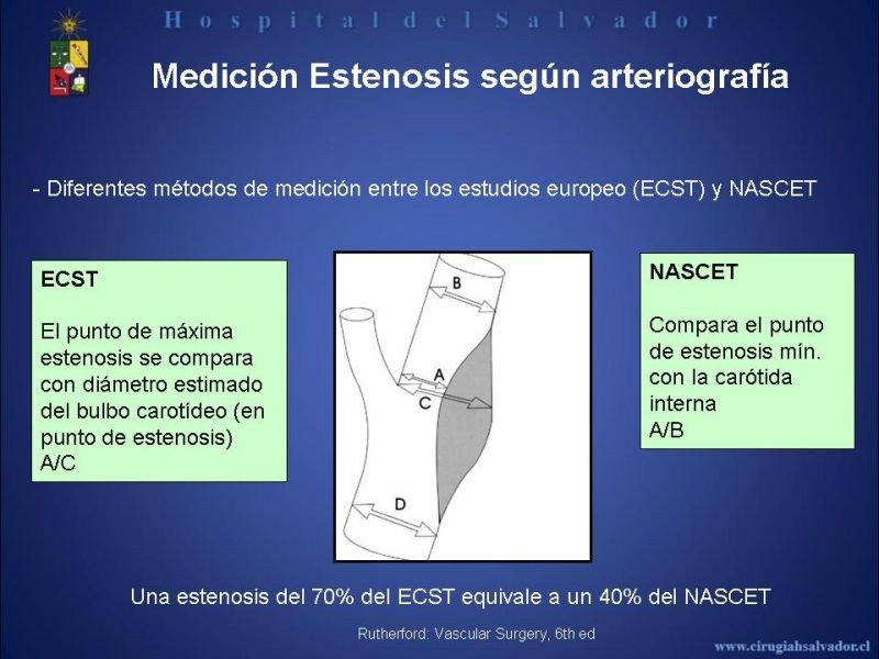 Diapositiva 11 de Patología Carotídea