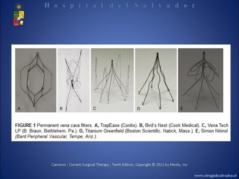 Diapositiva 8 de Filtro Vena Cava