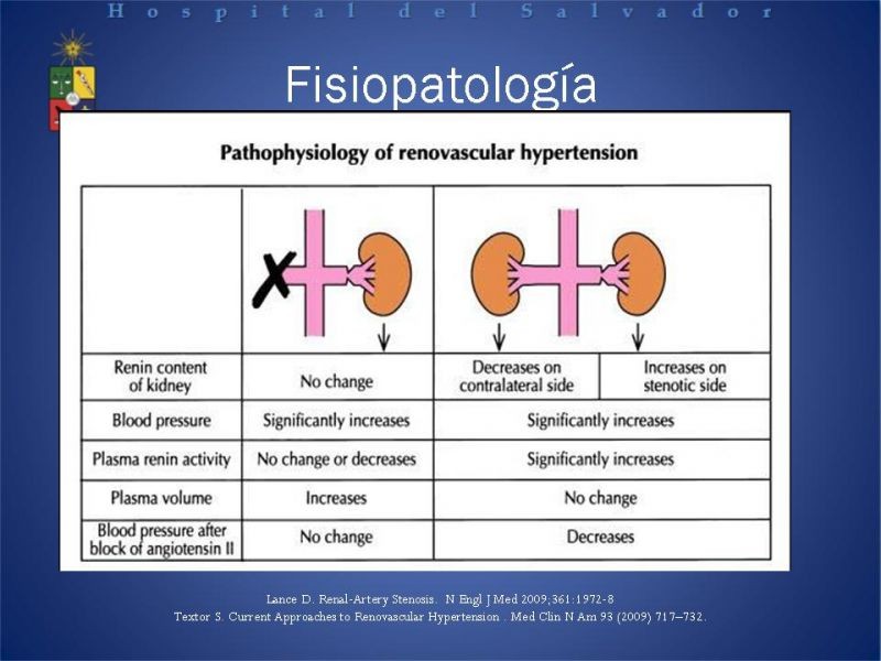Diapositiva 6 de Hipertensión renovascular