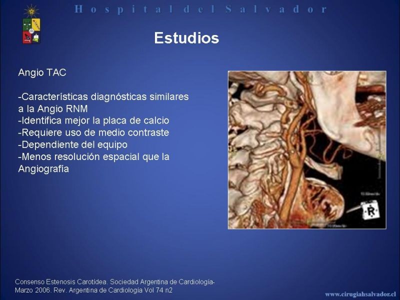 Diapositiva 8 de Patología Carotídea