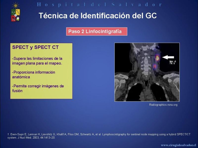 Diapositiva 28 de Rol del Ganglio Centinela en Melanoma