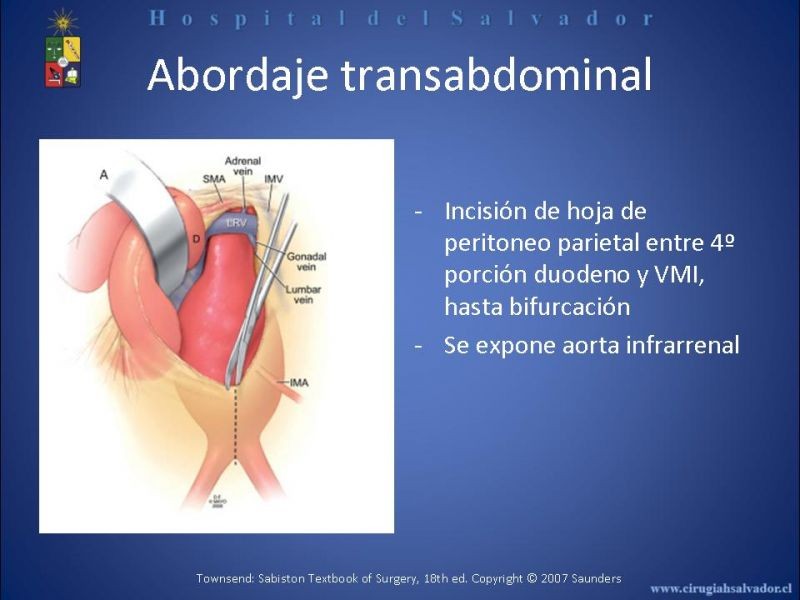 Diapositiva 13 de Abordaje de Aorta abdominal