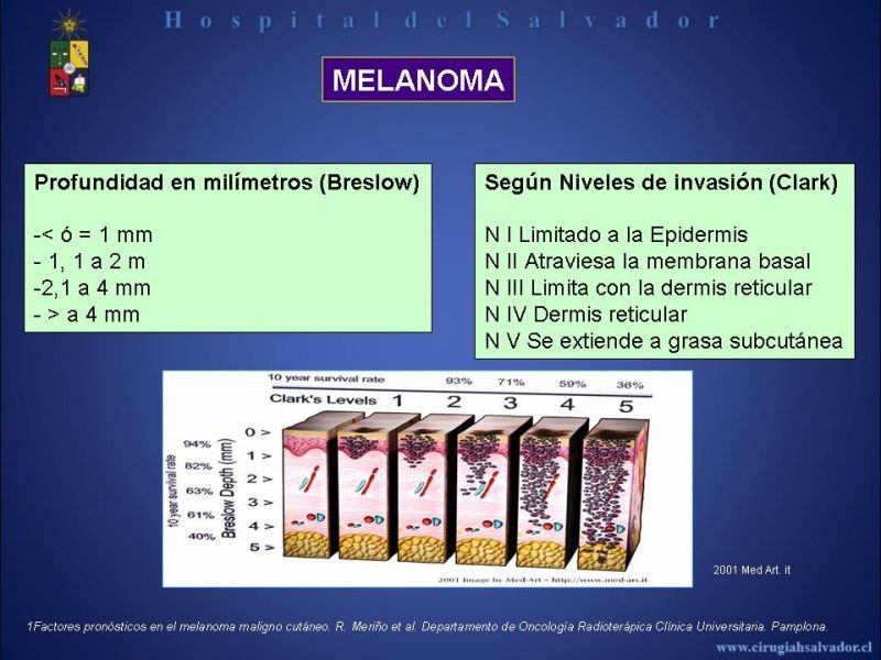 Diapositiva 4 de Rol del Ganglio Centinela en Melanoma