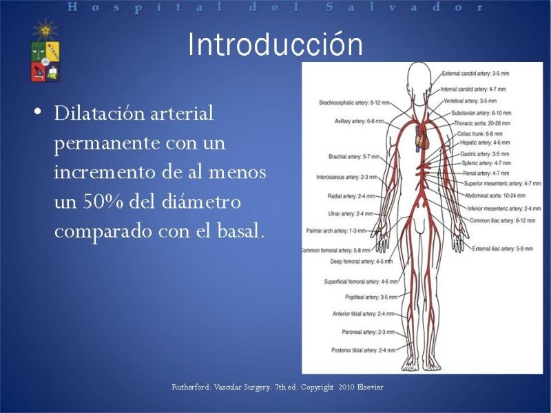 Diapositiva 1 de Aneurismas Arteriales EEII